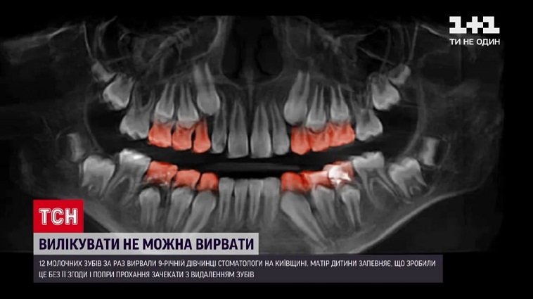 зубы