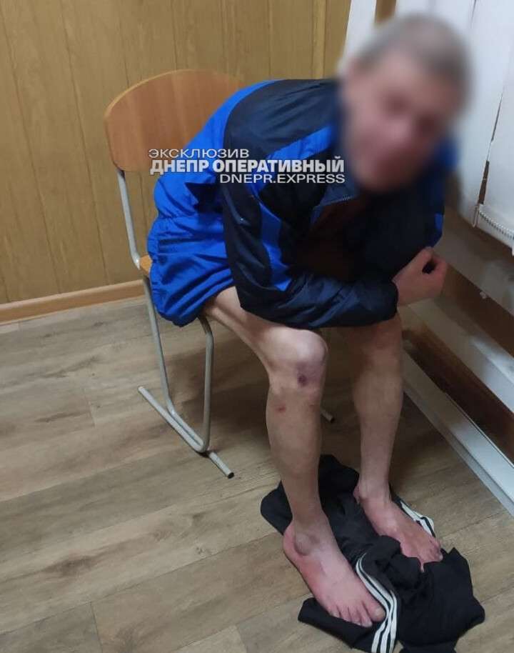 В Днепре голый мужчина изуродовал чужой автомобиль: его забрали в психбольницу