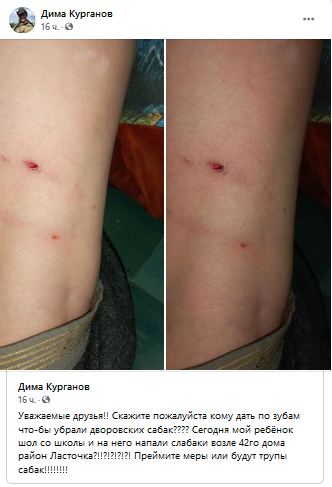 В Кривом Роге дворовые собаки напали на ребенка