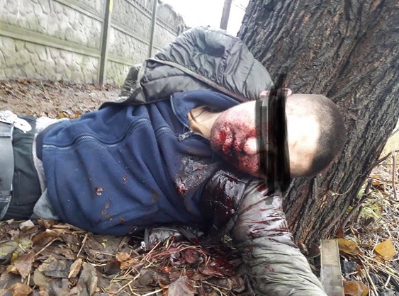 Неизвестные взорвали во рту молодого павлоградца петарду