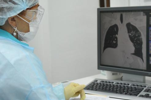 Врачи перечислили шесть ключевых признаков бессимптомной пневмонии