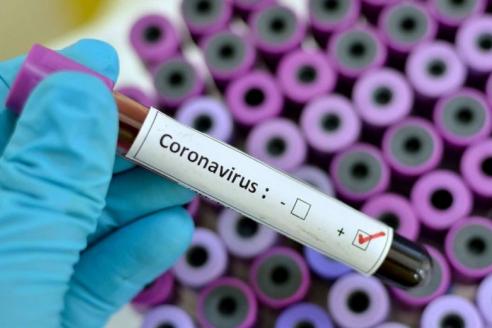 Зараженных коронавирусом в Украине больше, чем в статистике: кого не учитывают