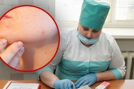 Рак может вызвать хроническое воспаление кожи